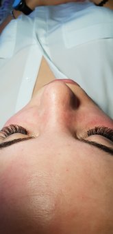Piling of accusation in the &quot;health derma&quot; cosmetologist at kharkov. rob with knowledge.