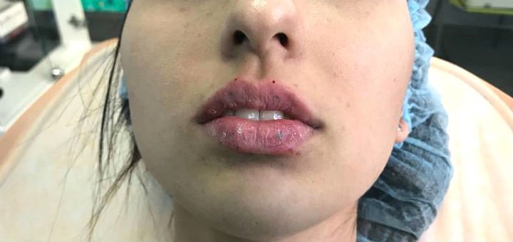 Інвазивна косметологія у медичному центрі «Sono» у Запоріжжі. Записуйтесь до косметолога за знижкою.
