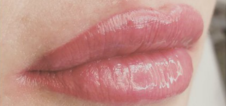 Lip correction