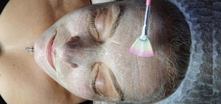 Чистка обличчя у «Perfect Cosmetology» у Києві. Замовити недорого