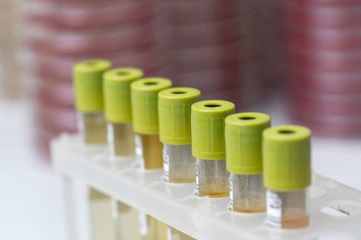 Лаборатория «Invitro». Скидки на анализы