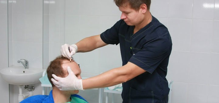 Пересадка волосся в центрі «rubenhair». лікування облисіння зі знижкою.